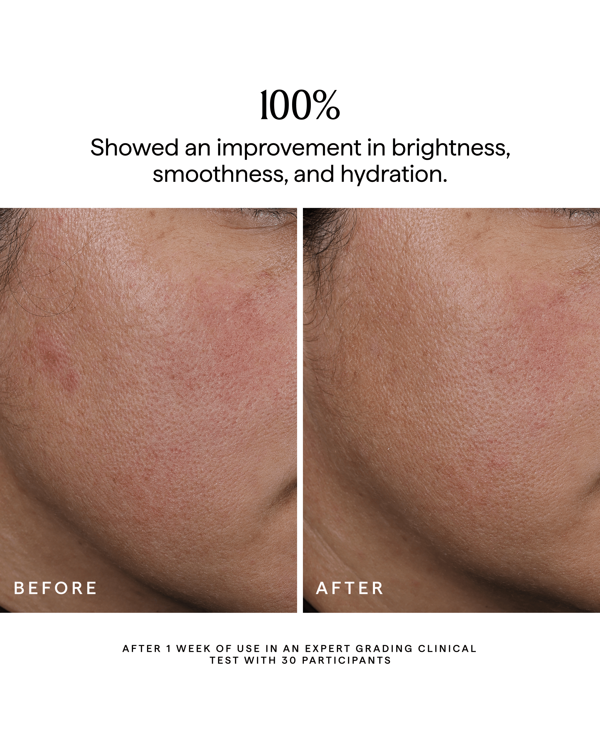 NOVA Turmeric + Niacinamide Bi-Phase Glow Facial Oil